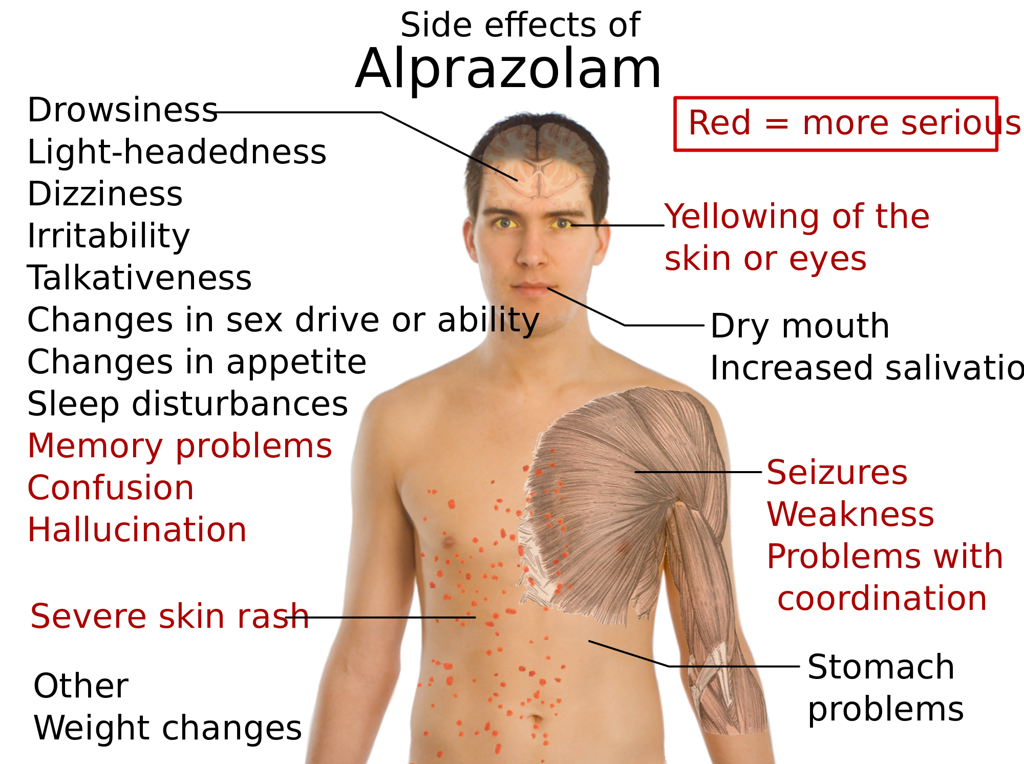 Tramadol allergic reaction rash